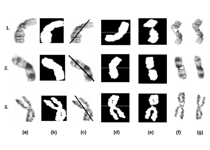 Crowdsourcing for Chromosome Segmentation and Deep Classification